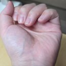 유일메디칼 | [제품리뷰] 영메디칼바이오 스파크캔슬링 정전기방지팔찌 사용 후기 (정전기방지용품/정전기방지)