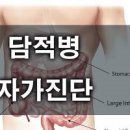 담적병 자가진단 방법 원인 이미지