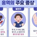 (감염병) 홍역 이미지