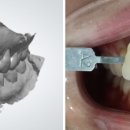 단원치과기공소 이미지