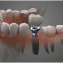 양평치과의원 이미지