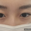 루비왁싱스킨 이미지
