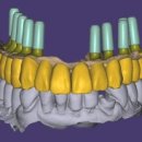 가야치과기공소 이미지