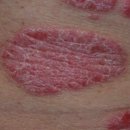 미클린의원 이미지