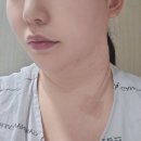 pet200머4928 | 200큐리 고용량 동위원소 3박4일 후기 (강남 세브란스)