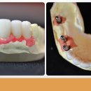 다이아몬드치과기공소 이미지