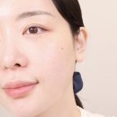 알파코드 | 용산피부과 추천 덴서티 알파 600샷 관리 후기 듀얼 고주파 리프팅 솔직후기