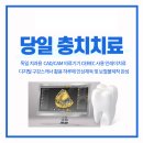 더고운치과기공소 네이버블로그