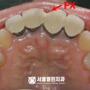 서울아인치과의원 이미지