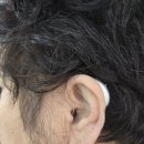 제일보청기 이미지