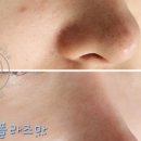 초이스메디 네이버블로그