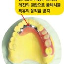 프레임치과기공소 이미지