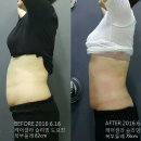 캡틴케어 네이버블로그