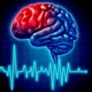 뇌졸중의 예방과 치료 이미지