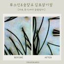 (주)스틸앤정수 | [김포두피관리] ”뷰티앤숲칼프 장기점“ 두피상태 정밀 진단부터 아로마 헤드스파까지 솔직후기!
