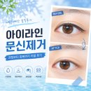 김은영유외과의원 | 내돈내산 아이라인 문신 제거 후기 | 붓기, 멍, 딱지 변화 총정리 (1~5일차)