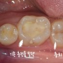 동탄키움치과의원 이미지