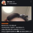 다비치히어링부평산곡점 | M자 헤어라인 고민? 채우지 말고 정리하세요! 헤어라인 왁싱 전후 변화(꾸준한 관리 후기)