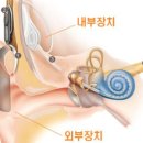 목동청각센터 이미지