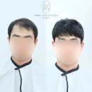 뷰라이프위그갤러리