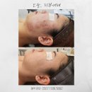 오늘, 피부어때