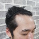 차세대헤어라인