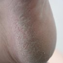 아이캔네일 이미지