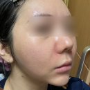더랩바이블랑두 올리고 히알루론산 캡슐 젤리 미스트 수분 꽉 잠금 미스트 화잘먹 피부 이미지