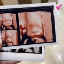 미래로21병원 | [임신21주] 덕천 미래로병원 정밀초음파 후기👼