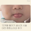 대전튼튼의원 | 13개월 돌아기 설소대 시술 대전 튼튼소아과 후기
