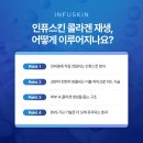 효의료기기 | 인퓨스킨 후기 | 통증 적은 캐뉼라 스킨부스터 1일차, 3일차, 7일차 변화 솔직후기 명동역피부과