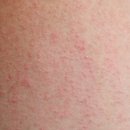 나인의원 이미지