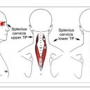 Splenius Cervicis (경판상근) 이미지