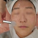원흥4로 | 원흥역 피부관리 4W에스테틱에서 하이푸 관리 받고 찐 만족한 후기