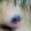 보라약국 | 아기 멍크림 약국 사용해도 될까 걱정된다면 꿍크림 사용해본 후기