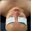 솜 에스테틱 이미지