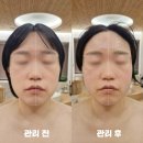 세븐일레븐 광주상무골든빌점 | 광주 윤곽관리 테라피스파 소베 상무점 윤곽관리 추천 후기!
