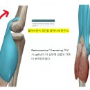 안바핏