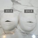 어반이프 | 얼굴라인이 달라졌어요✨ 구리피부관리 갈매동 어반에스테틱 리뷰/ 주차/비포&에프터
