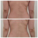 씨유 옥정이편한제일점 | 옥정웨딩관리 뷰티온 피부&amp;헤드스파에서 올인원 웨딩케어를 받아보자