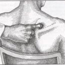 극상근 " Subdeltoid Bursitis Mimicker " 이미지