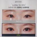 엣지성형외과의원 이미지