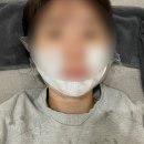 [명동역피부과] 새로 개원한 명동 피부과에서 슈링크 받은 후기