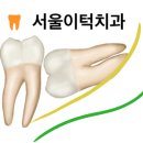 서울이턱사랑니치과의원 이미지