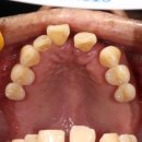 치아룸 치과기공소 이미지