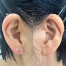 귀로 보는 건강클리닉 이혈 | 이어테라피자격증(이혈테라피) 클래스 주말반 종강후기