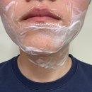 노벨의원 | 다시 시작하는 레이저제모 신촌노벨의원