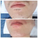 뷰티호텔 미장점 | 군산 왁싱추천! 뷰티호텔미장점 방문후기!