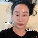 울산 두피케어 리프팅 관리 페이스트리 스칼프핏 헤드스파 후기