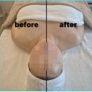 🔥 강력 추천하는 예신 바디케어 샵! 결혼 준비하면서 바디라인 고민된다면? 주바나스파 림프 디톡스 후기
